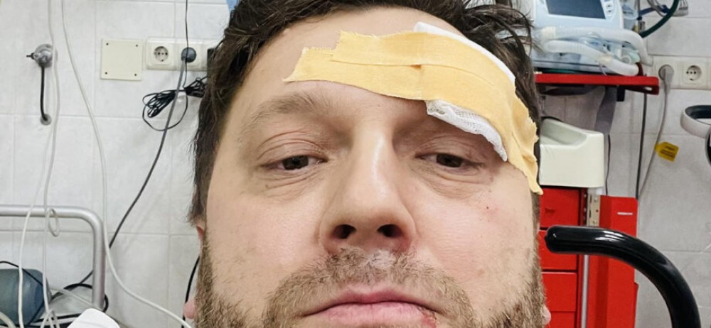 După Alaiba, încă un deputat PAS a venit la Parlament accidentat